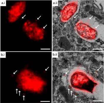 STORM-CLEM Image of Bioorthogonal Salmonella in Host Cell Phagosome